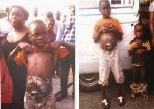 Two women caught after making children beg with fake wounds in Lagos (Photos) peculiarmagazine